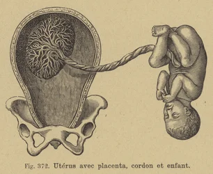 Schnittansicht eines Mutterleibs mit Plazenta, Nabelschnur und Baby